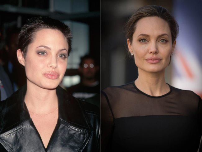 Angelina Jolie rhinoplastik